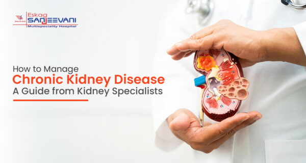 How to Manage Chronic Kidney Disease: A Guide from Kidney Specialists