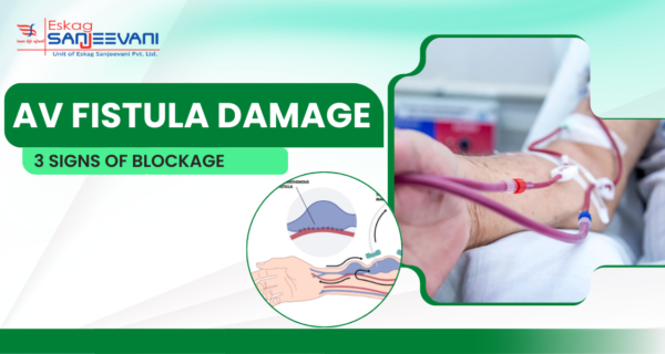 AV fistula damage