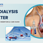Hemodialysis Catheter