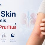itchy skin on dialysis
