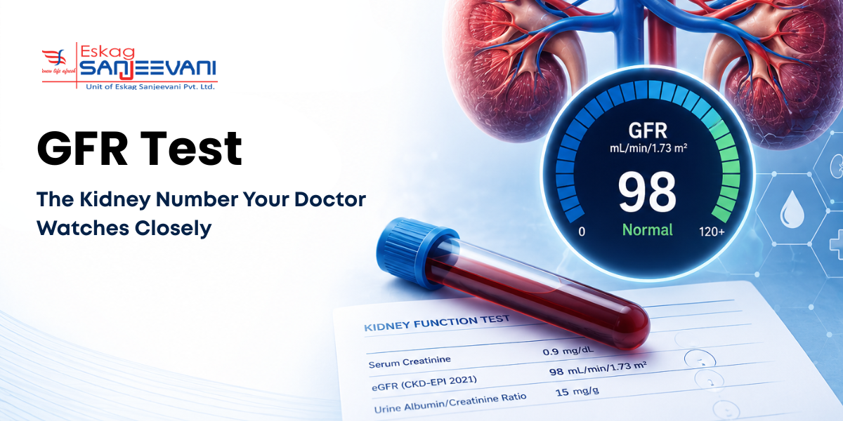 what is the GFR test